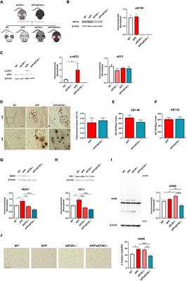 Homozygous knockout of eEF2K alleviates cognitive deficits in APP/PS1 Alzheimer’s disease model mice independent of brain amyloid β pathology